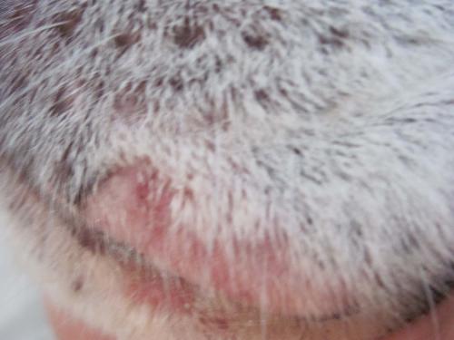 Acne a un culmine su una faccia