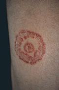 Calzini per gambe da un fungo