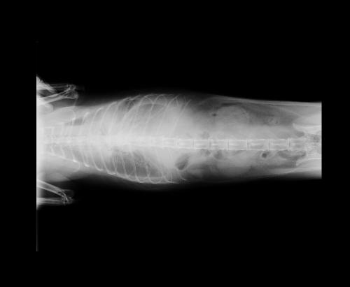 può prostare metastasi ai polmoni